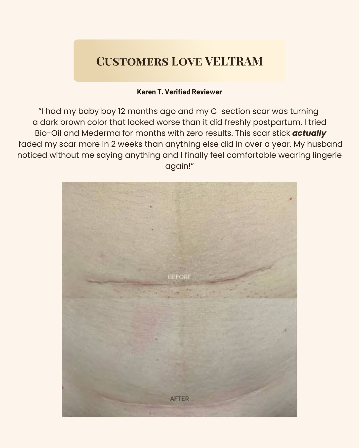 Silicone Scar & Wrinkle Stick